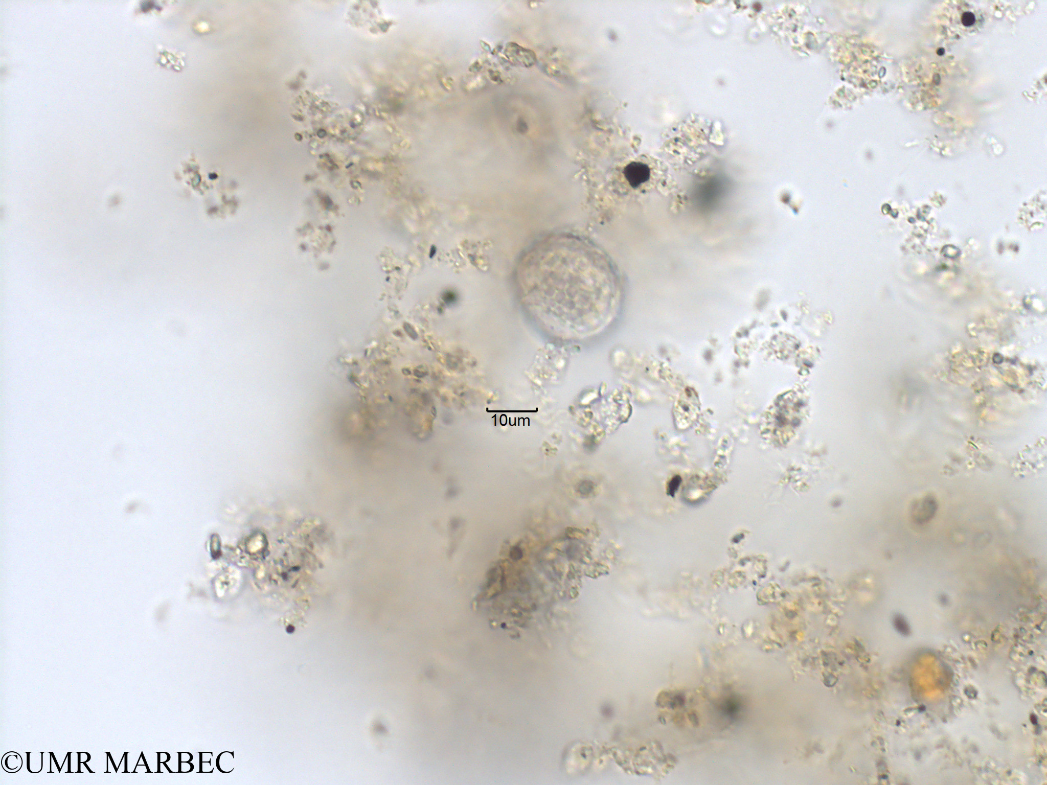 phyto/Bizerte/bizerte_bay/RISCO November 2015/Palaeophalacroma sp (Protoceratium sp3 -Baie_T1B-cf Protoceratium-3)(copy).jpg
